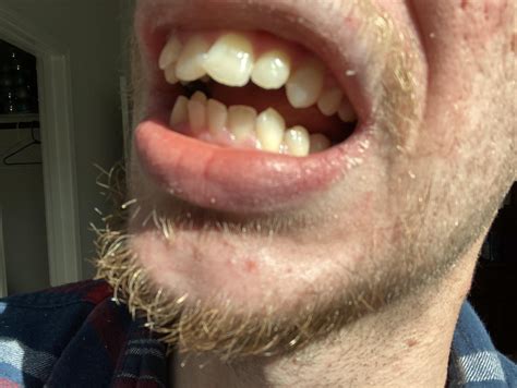 r/askdentists|/r/askdentists .